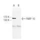 PARP-10 Antibody (5H11) - Western Blotting - Image 47816