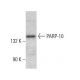 PARP-10 Antibody (6D643) - Western Blotting - Image 380353
