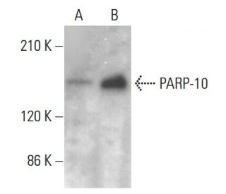 PARP-10 Antibody (6D643) - Western Blotting - Image 385278Each CRISPR/Cas9 Knockout (KO) Plasmid product consists of a pool of 3 plasmids designed to ensure identification and cleavage of a specific gene for maximum knockout efficiency. Each plasmid encodes a unique 20 nt sequence derived from the GeCKO (v2) library.
