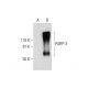 PARP-3 Antibody (C-1) - Western Blotting - Image 289818