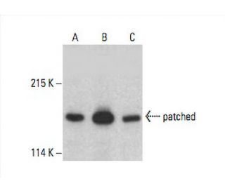 patched/PTCH1 Antibody (A-2) - Western Blotting - Image 393015 