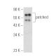 patched/PTCH1 Antibody (E-7) - Western Blotting - Image 389907 