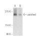 patched/PTCH1 Antibody (E-7) - Western Blotting - Image 389908 