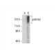patched/PTCH1 Antibody (E-7) - Western Blotting - Image 392884