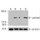 patched/PTCH1 抗體 (H-10):sc-518102。Western blot分析未處理HeLa(A)、化學處理HeLa(B)、未處理K-562(C)及化學處理K-562(D)全細胞裂解液中patched的表達。β-肌動蛋白(C4):sc-47778用作載量對照。檢測試劑:m-IgG Fc BP-HRP:sc-525409。 patched/PTCH1 Antibody (H-10) - Western Blotting - Image 416145