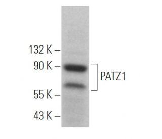 PATZ1 Antibody (H-2) - Western Blotting - Image 364512 