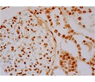 Pax-3/7 Antibody (E-10) - Immunohistochemistry - Image 286401 