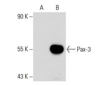 Pax-3 Antibody (6288D4a) - Western Blotting - Image 48175 