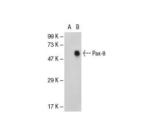 Pax-8 Antibody (PAX8R1) - Western Blotting - Image 49293 