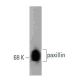 paxillin Antibody (177) - Western Blotting - Image 127469