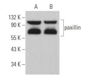paxillin Antibody (C-1) - Western Blotting - Image 362924 