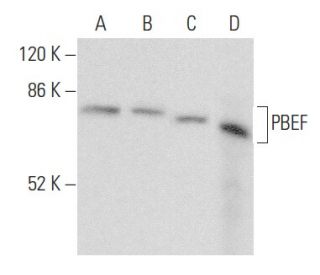 PBEF Antibody (1D3A12) - Western Blotting - Image 354976 