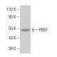 PBEF Antibody (E-10) - Western Blotting - Image 380555