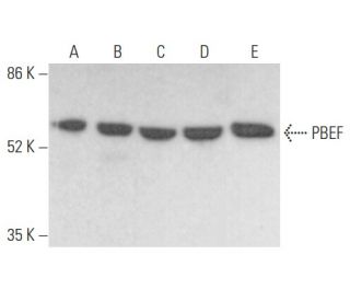 PBEF Antibody (F-5) - Western Blotting - Image 355131 