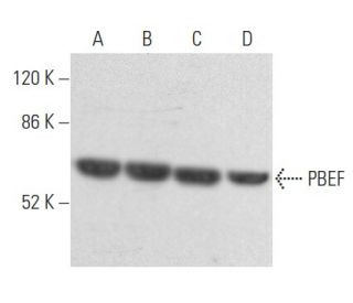 PBEF Antibody (H-11) - Western Blotting - Image 354977 