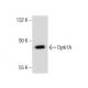 Dyrk1A (A-16): sc-12571. Western blot analysis of Dyrk1A expression in PC-3 whole cell lysate. 