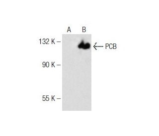 PCB Antibody (F-3) - Western Blotting - Image 141696 