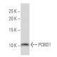 PCBD1 Antibody (CD-37) - Western Blotting - Image 33859 