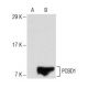 PCBD1 Antibody (CD-37) - Western Blotting - Image 154167