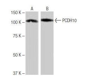 PCDH10 Antibody (2-YD37) - Western Blotting - Image 65029
