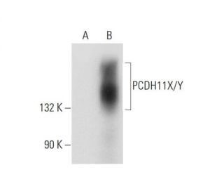 PCDH11X/Y Antibody (D-2) - Western Blotting - Image 314543