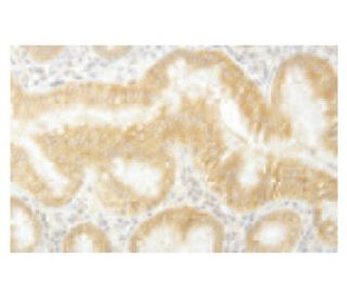 PCDHA10 Antibody (JH-86) - Immunohistochemistry - Image 53962