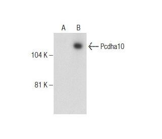 PCDHAC Antibody (2C1/E7) - Western Blotting - Image 160456