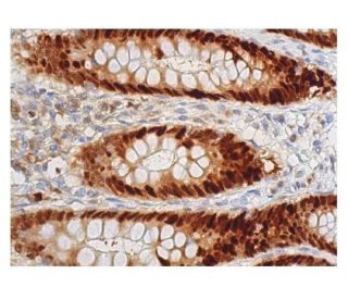 PCNA Antibody (6D645) - Immunohistochemistry - Image 348774 