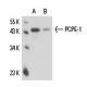 PCPE-1 Antibody (10D9) - Western Blotting - Image 16300 