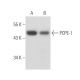 PCPE-1 Antibody (7A11/1) - Western Blotting - Image 16299 