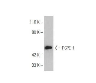 PCPE-1 Antibody (7A11/5) - Western Blotting - Image 47811