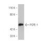 PCPE-1 Antibody (7A11/5) - Western Blotting - Image 47811
