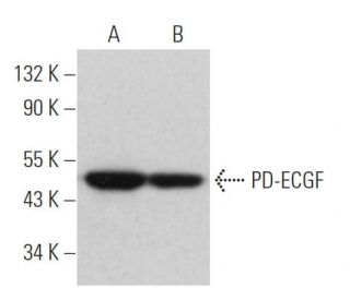 PD-ECGF Antibody (0.N.568) - Western Blotting - Image 365600 