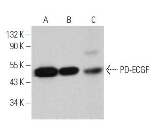 PD-ECGF Antibody (6A162) - Western Blotting - Image 364538 