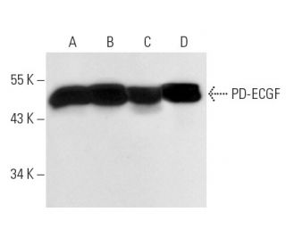 PD-ECGF Antibody (PGF-44C) - Western Blotting - Image 11049 