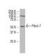 Pdcd-7 Antibody (S-18) - Western Blotting - Image 34609