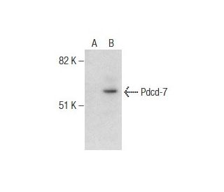 Pdcd-7 Antibody (S-18) - Western Blotting - Image 282118 