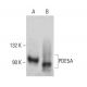 PDE5A Antibody (D-3) - Western Blotting - Image 388033 