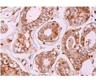 PDGF-A Antibody (E-10) - Immunohistochemistry - Image 369599 