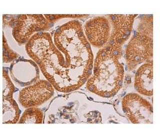 PDGF Receptor beta/PDGFRB Antibody (18A2) - Immunohistochemistry - Image 352967 