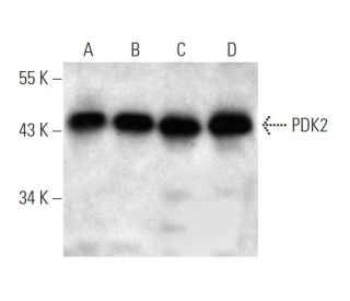 PDK2 Antibody (180CT10.2.3) - Western Blotting - Image 374562