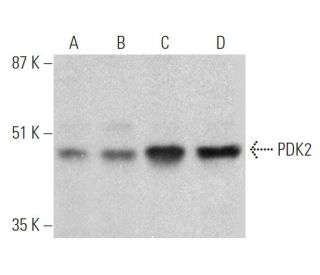 PDK2 Antibody (3F2D7) - Western Blotting - Image 368227