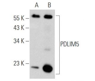 PDLIM5 Antibody (G-2) - Western Blotting - Image 353735