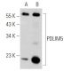 PDLIM5 Antibody (G-2) - Western Blotting - Image 353735