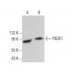 PDZK1 Antibody (E-9) - Western Blotting - Image 383701