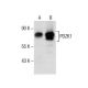 PDZK1 Antibody (F-36) - Western Blotting - Image 285860 