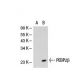 PEBP2β Antibody (141,4,1) - Western Blotting - Image 21695