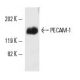 CD31/PECAM-1 Antibody (P2B1) - Western Blotting - Image 5080