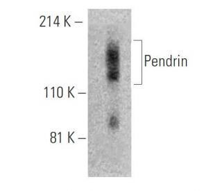 Pendrin Antibody (G-11) - Western Blotting - Image 395941