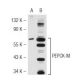 PEPCK-M/PCK2 Antibody (62-W) - Western Blotting - Image 42822